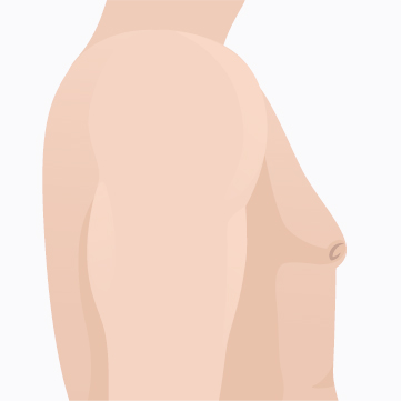 1단계