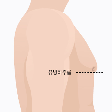 2단계