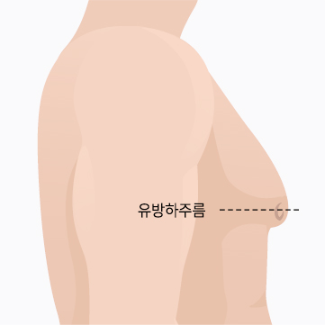 3단계