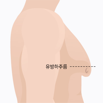 4단계