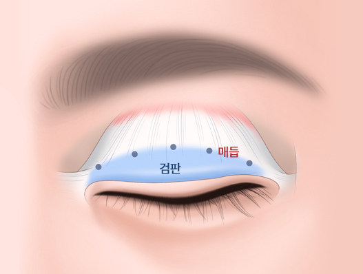 검판 / 매듭